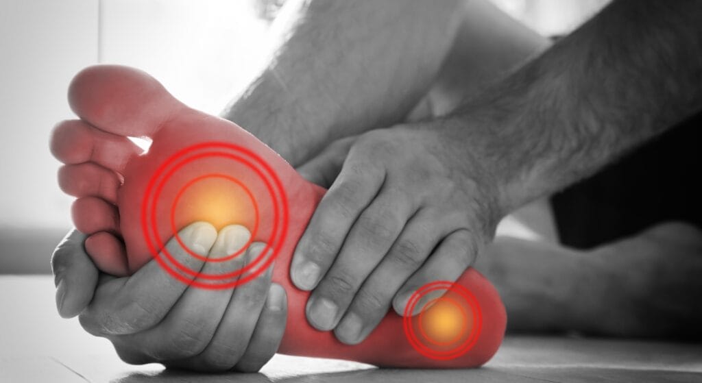 Đau gan bàn chân khi chạy: Đừng chỉ đổi giày, hãy xử lý từ gốc